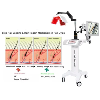 Máquina láser para el crecimiento del cabello 650nm para el tratamiento de la pérdida del cabello para el crecimiento del cabello